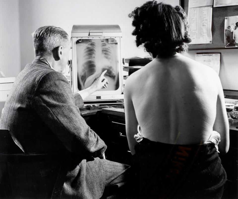  A patient with a chest specialist at a Bristol health centre as they inspect a chest x-ray of their lungs