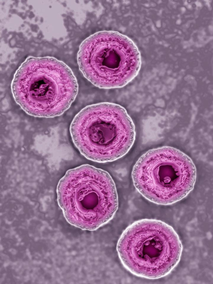 The drug, which would be given three times over a six-month period, could prevent the virus, pictured under the microscope, being spread through the population