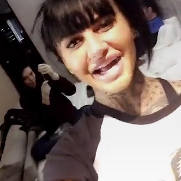  Glamour model Jemma Lucy shared video of herself being treated with Botox