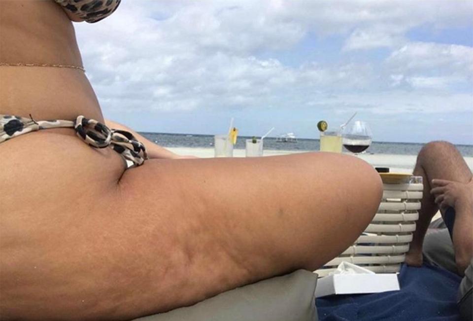  The 28-year-old shared a candid snap of the cellulite on her thighs on Instagram