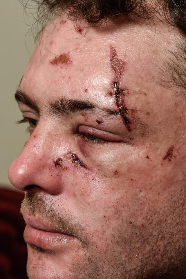  Lawrence told how he screamed at his attackers to stop the brutal assault