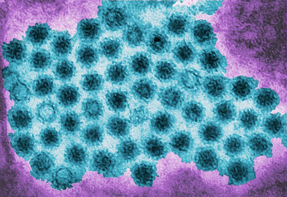 Norovirus, also called the winter vomiting bug, can make you projectile vomit and give you watery diarrhoea 