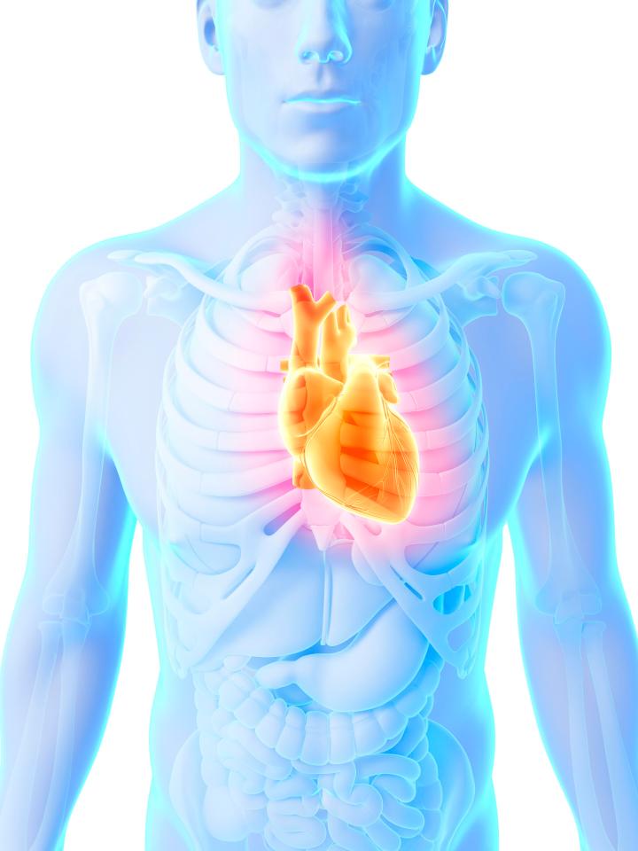 Using nonsteroidal anti-inflammatory painkillers to relieve a respiratory infection was associated with a 3.4-fold increased risk of heart attack