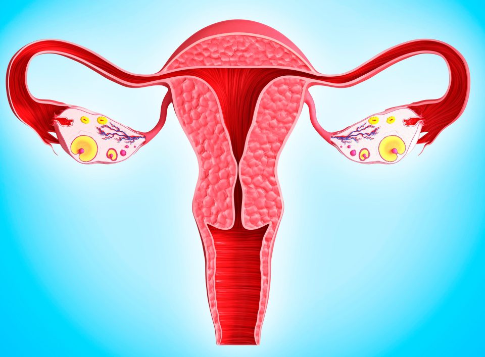  Ovarian cancer affects the female reproductive system and is one of the most common types of cancer in women