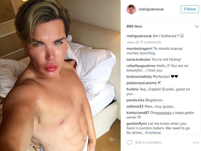  Rodrigo Alves went on This Morning last week and denied he was addicted to surgery