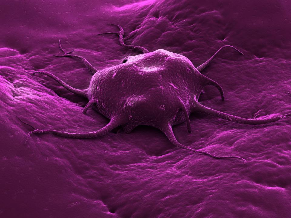  Fat cells produce hormones known to fuel tumour growth, meaning obesity is a huge risk factor for cancer