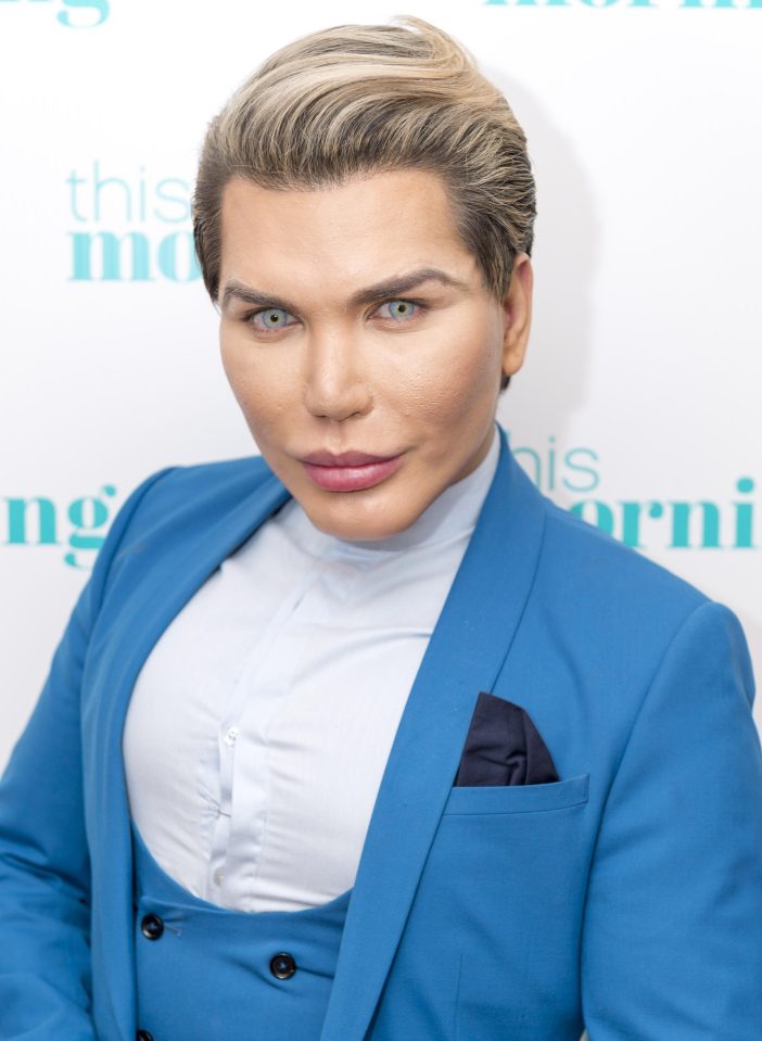  Rodrigo Alves is set to go on Big Brother after his latest round of surgery