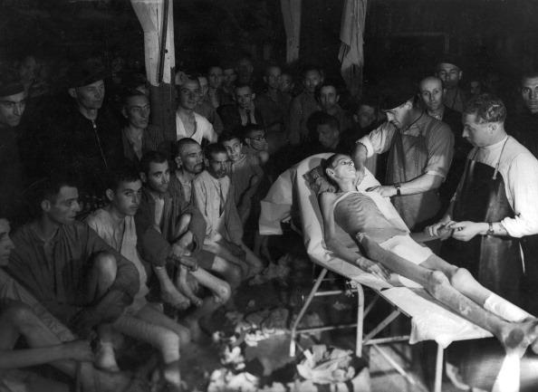  1945: Watched by former inmates of the Buchenwald concentration camp, Czech doctors examine an emaciated Hungarian Jew, following the camp's liberation