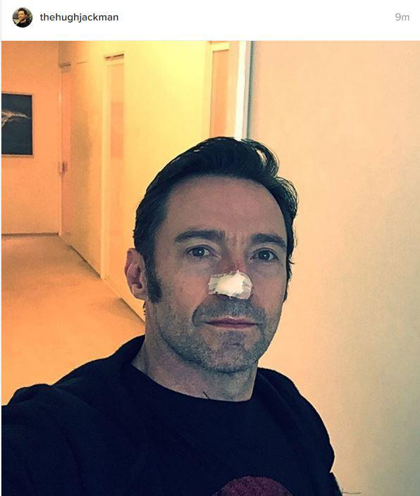  Hugh Jackman has given fans an update on his ongoing skin cancer battle