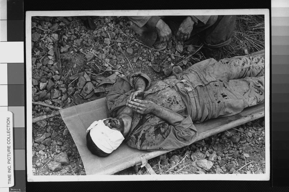  Blindfold-bandaged US soldier lying on a grounded stretcher, clasping hands as if in prayer, among casualties in WWII battle for Okinawa