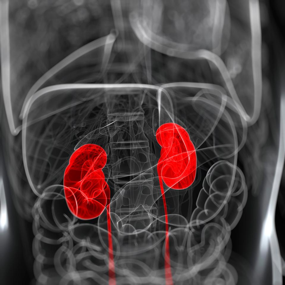 The kidneys were unable to filter waste from the blood, which can be deadly