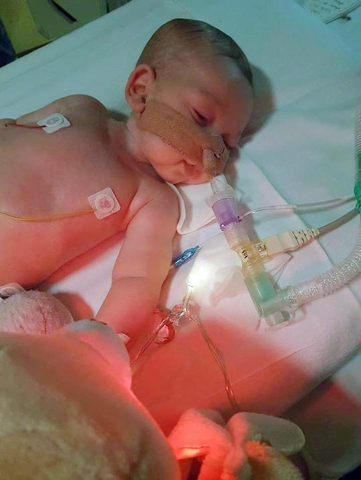  Baby Charlie suffers from a devastating disease, mitochondrial depletion syndrome