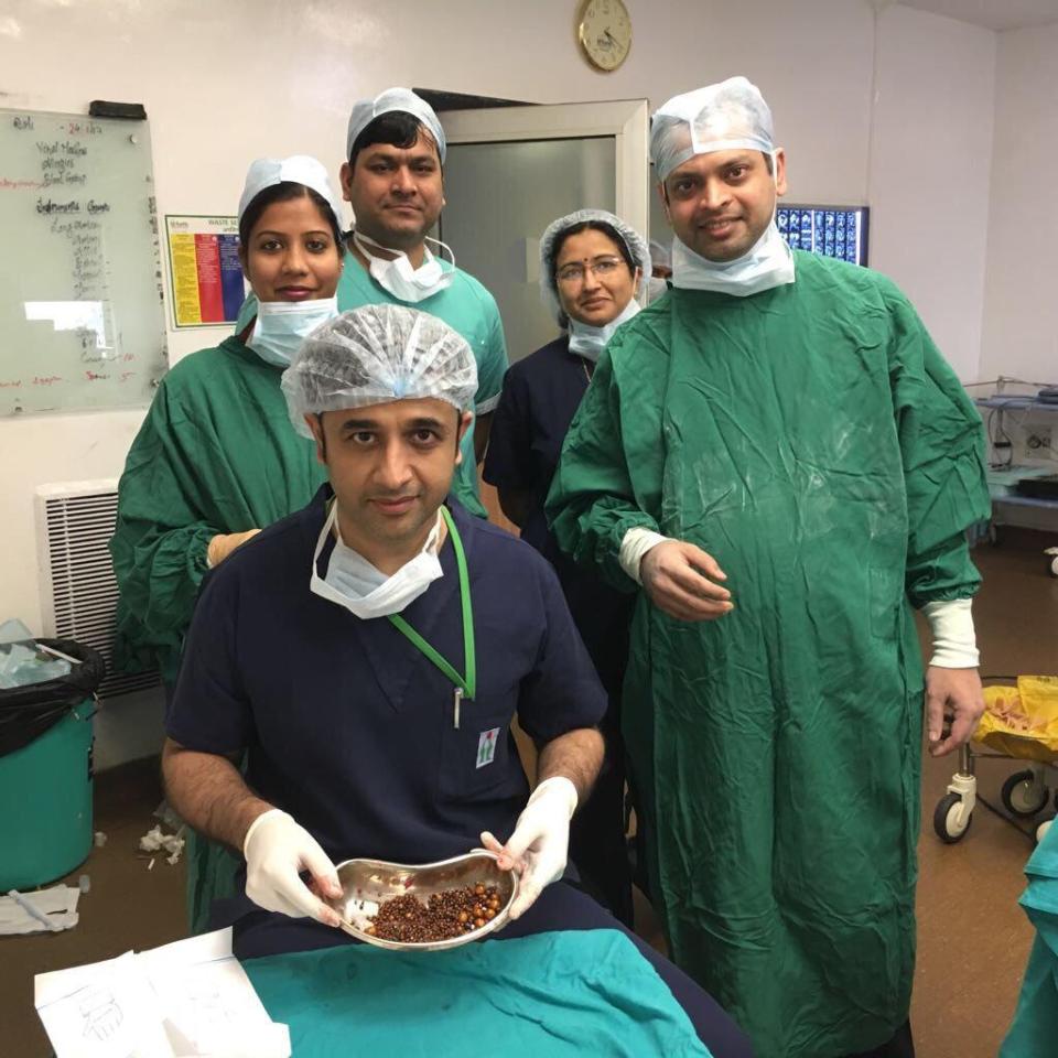 Dr Amit Javed with his team and the gallstones taken from Pushpa Devi, 60 from India