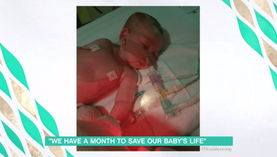  Baby Charlie has been in hospital since he was born