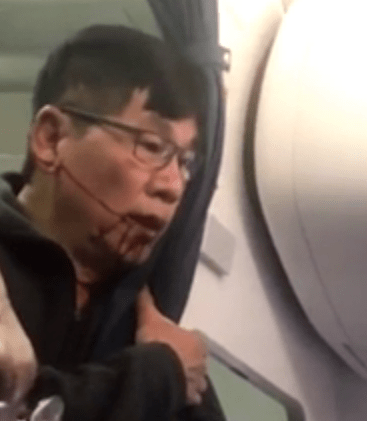  The man was seen bleeding from his face after he was dragged from his seat on the United flight