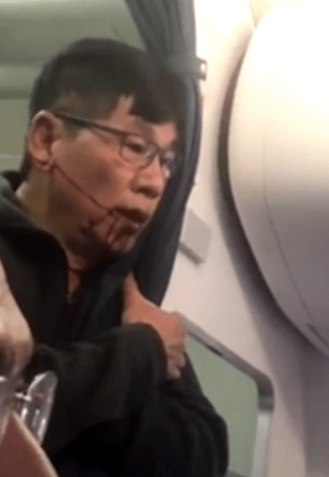  The man was seen bleeding from his face after he was dragged from his seat on the United Airlines flight