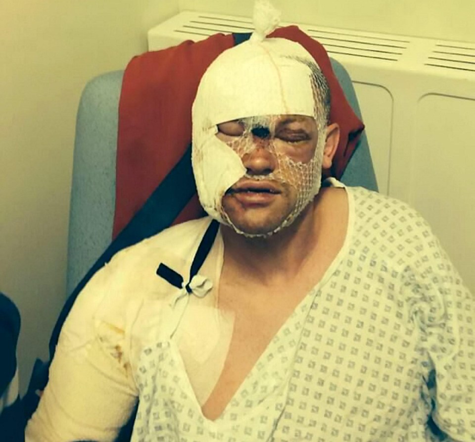 Darren was left in agony after being squirted with acid through open driver’s window