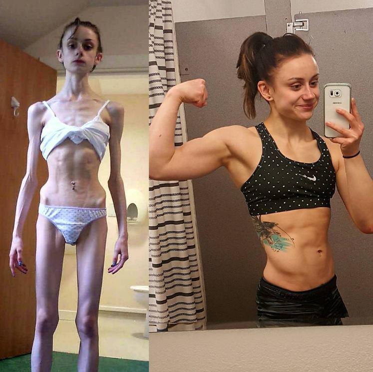  Fiona shared the shocking photo of her 18-year-old self, weighing just 4 stone 7lbs