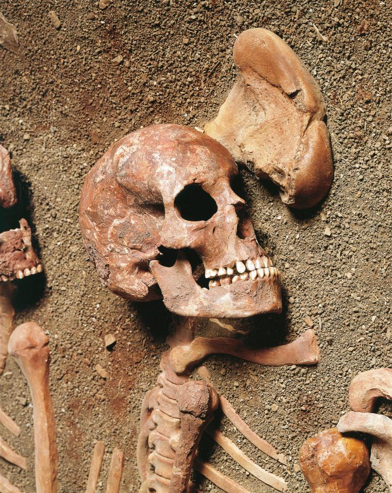 A study of human bones suggests our ancestors were terrified of a potential zombie invasion, pictured, a skeleton found at a burial site in Italy