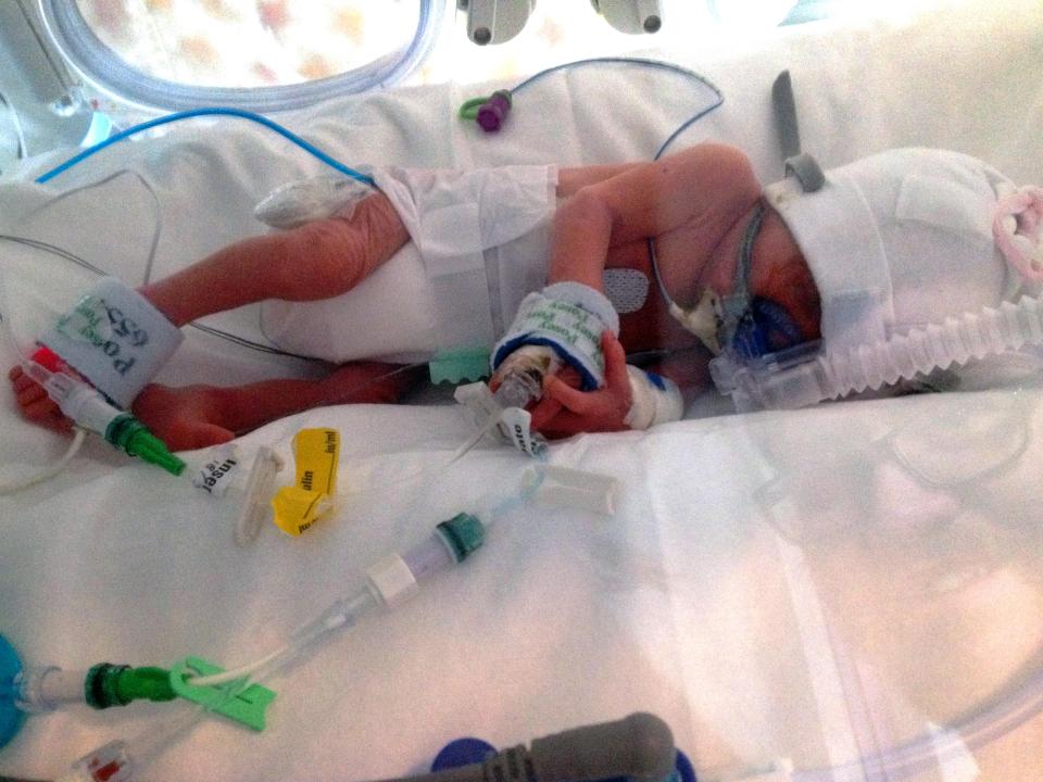  Charlie was born at 27 weeks and battled meningitis, sepsis and numerous infections