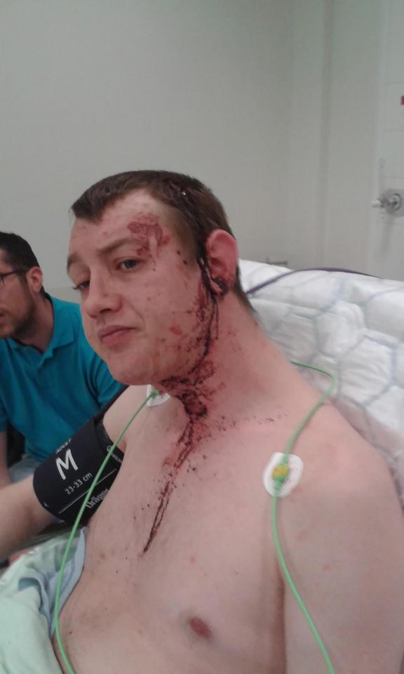  Horrific injuries ... Chris Shields, 39, says he was set upon by a gang of 10 teenage louts who 'cracked his head like an Easter egg'