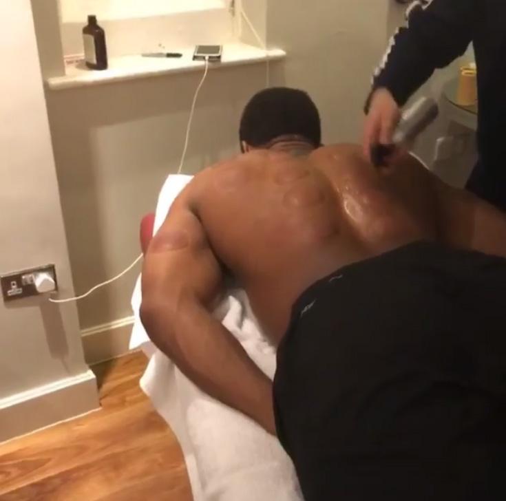  Anthony Joshua was laid on his front ready for some rather unusual treatment