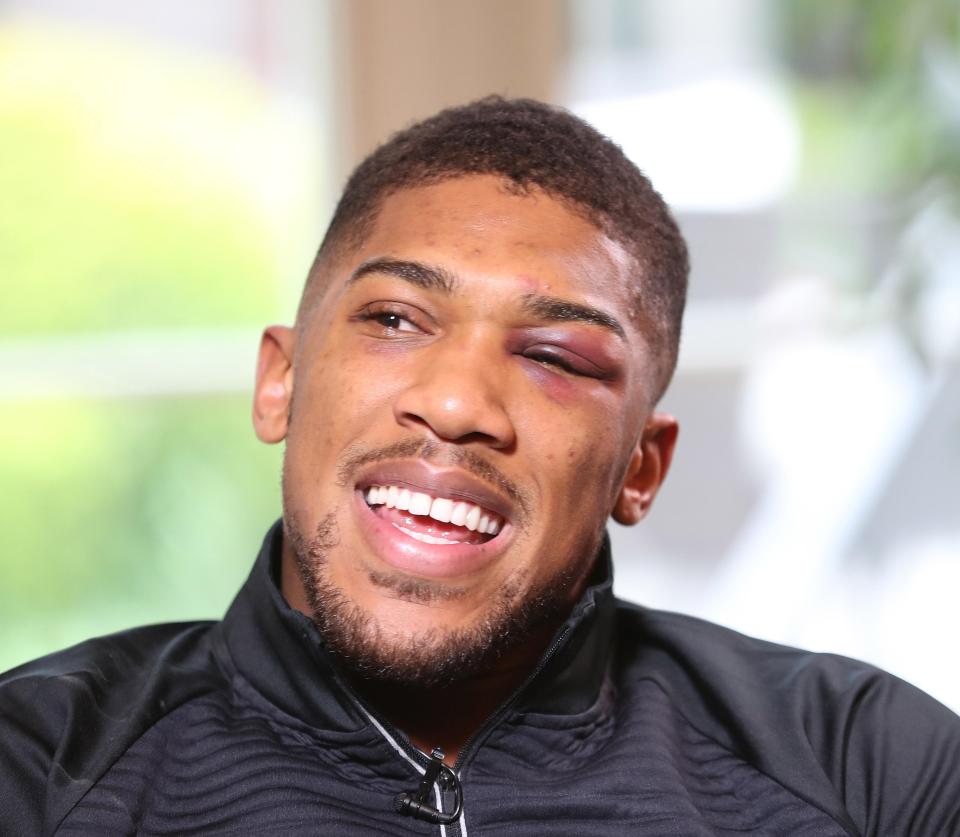 Anthony Joshua