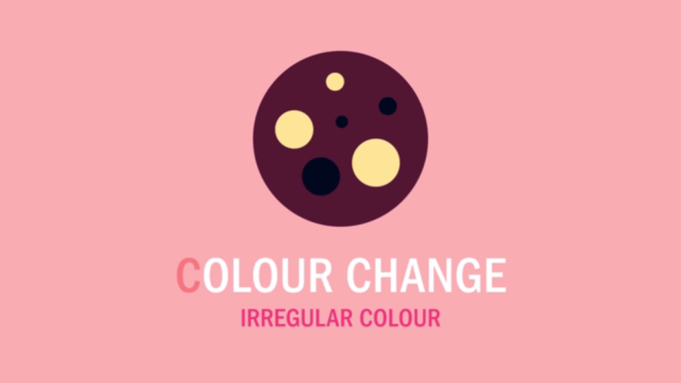  If the colour of the mole has changed or is unusual, it is worth having check out