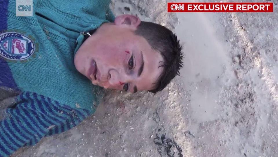  A young boy gasps for air in the aftermath of the attack