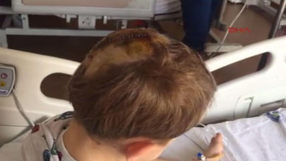  He suffered a severe wound on his head