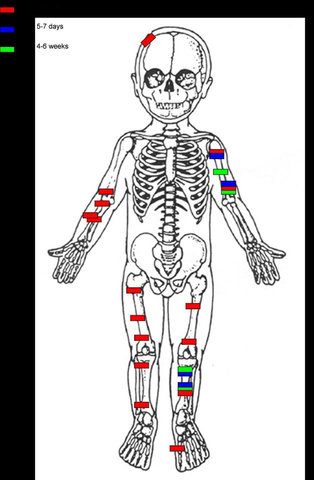 A graphic shows Noah suffered injuries all over his body as Hunjan and Tayler-Morrison subjected him to horrific abuse