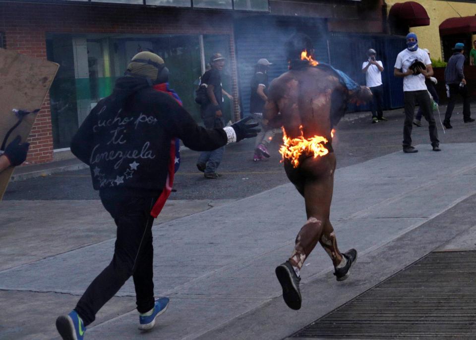  Protesters in Venezuela set a man on fire during a march in Caracas yesterday