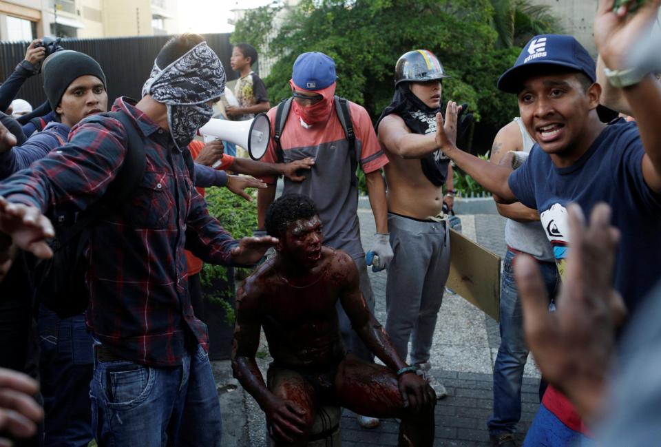  Following the blaze the man was surrounded by protesters keeping others away