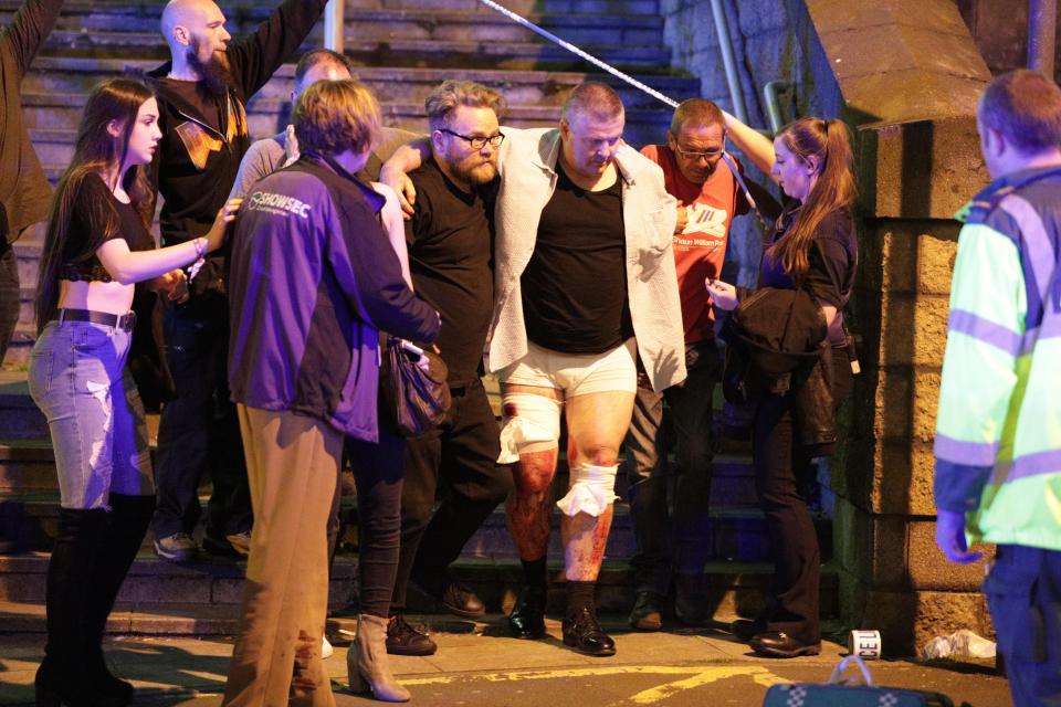  An injured man is led from the arena in Manchester after the chaos