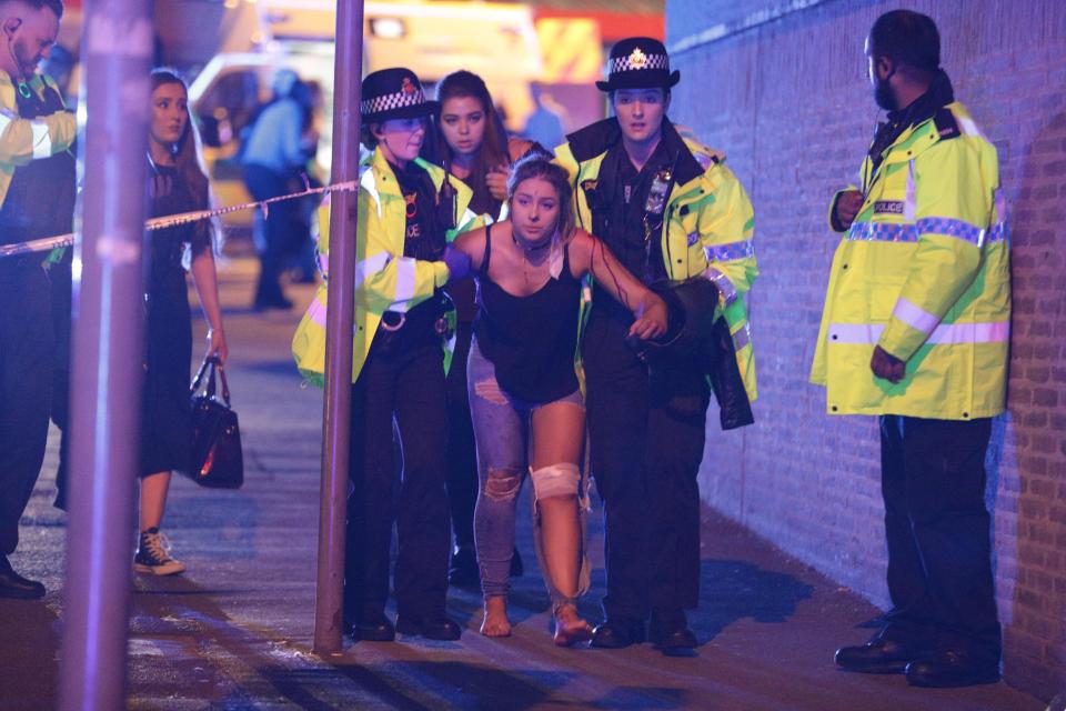 An injured woman is escorted from the arena by police after loud bangs were heard at the gig