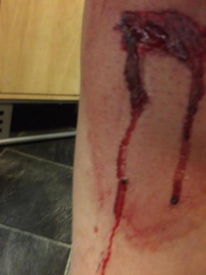  Another picture shows a deep gash across one of Lizzie's legs