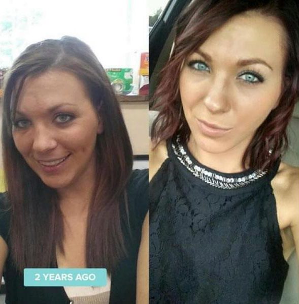  @ashley_zalot celebrated her two-year sober birthday when the picture on the right was taken. She said: 'The pic on the left is days before I entered detox for about the 5th time. I was a shell of a body with no soul, no hope and no faith. 2 years later and I live in the light of God. Through God and Alcoholics Anonymous, my life is literally beyond my wildest dreams'