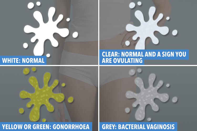  These are the colours you need to watch out for in your discharge