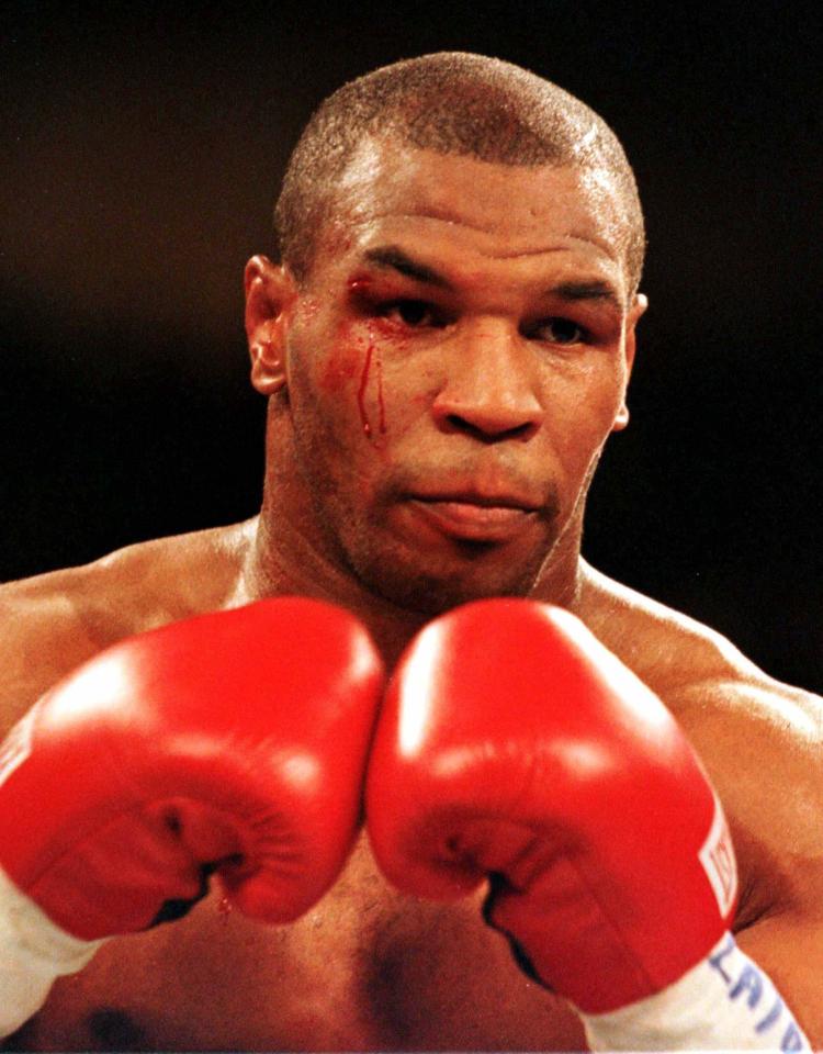  Tyson was left with a deep gash above his eye in both fights due to head clashes with Holyfield