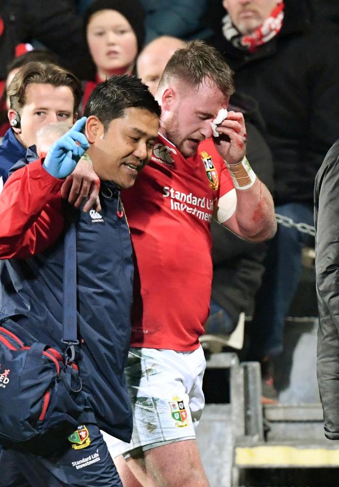  Stuart Hogg was hauled off for the incident where he ran into Conor Murrays elbow