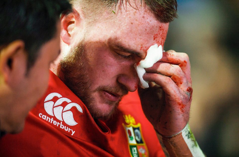  Stuart Hogg was hauled off after running into Conor Murray's elbow in a freak collision against the Crusaders