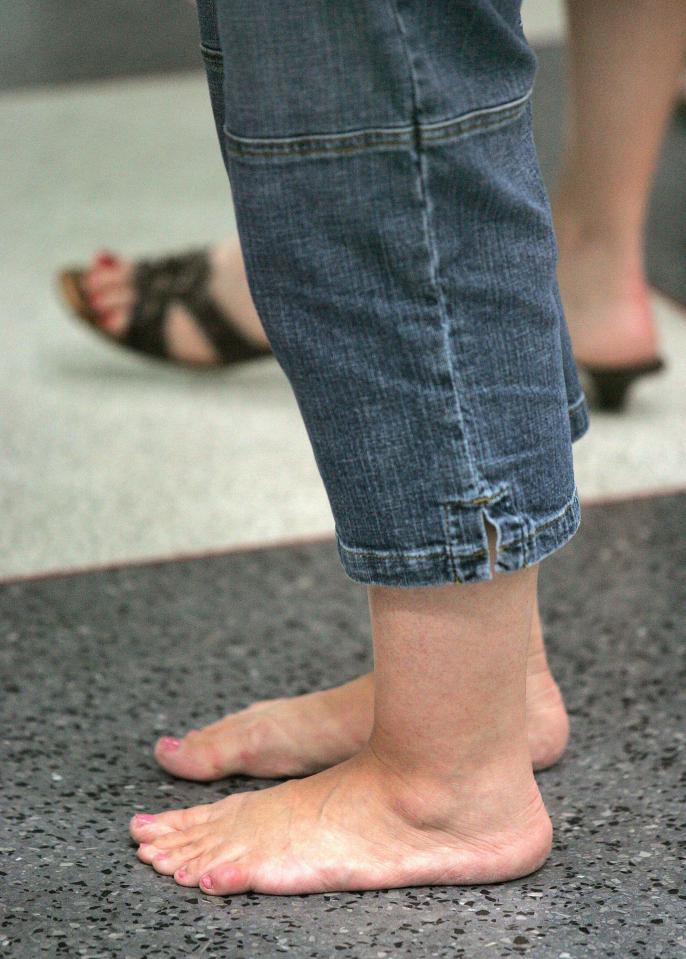  Thanks to millions of people walking around shoeless, there is a big risk of fungal infections at airport security