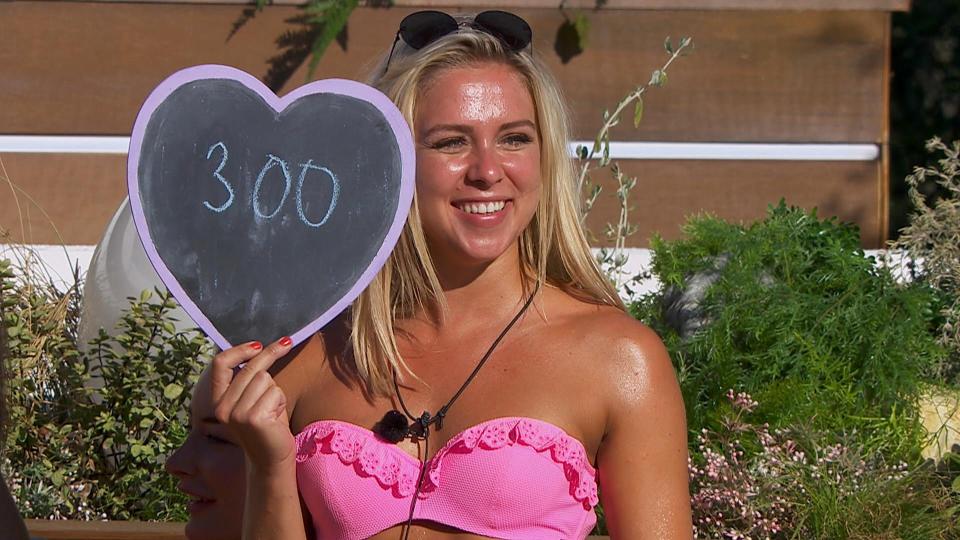  Gabby revealed before she went in the villa that she had an eighteen-inch scar down her back due to a crippling scoliosis operation