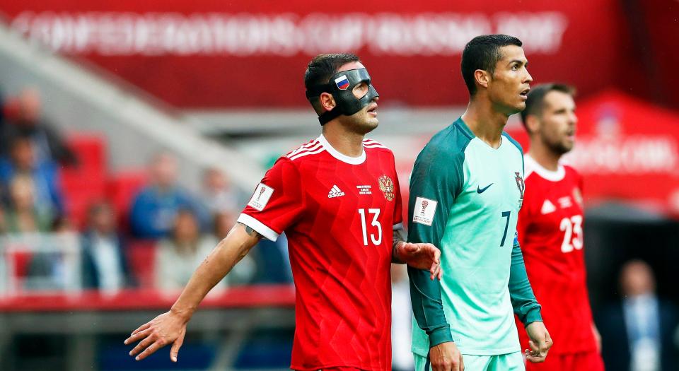  Ronaldo was marked by a masked man during the game