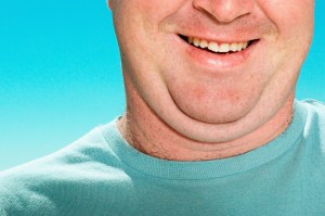 There are many factors that can give you a double chin, including weight gain and genetics