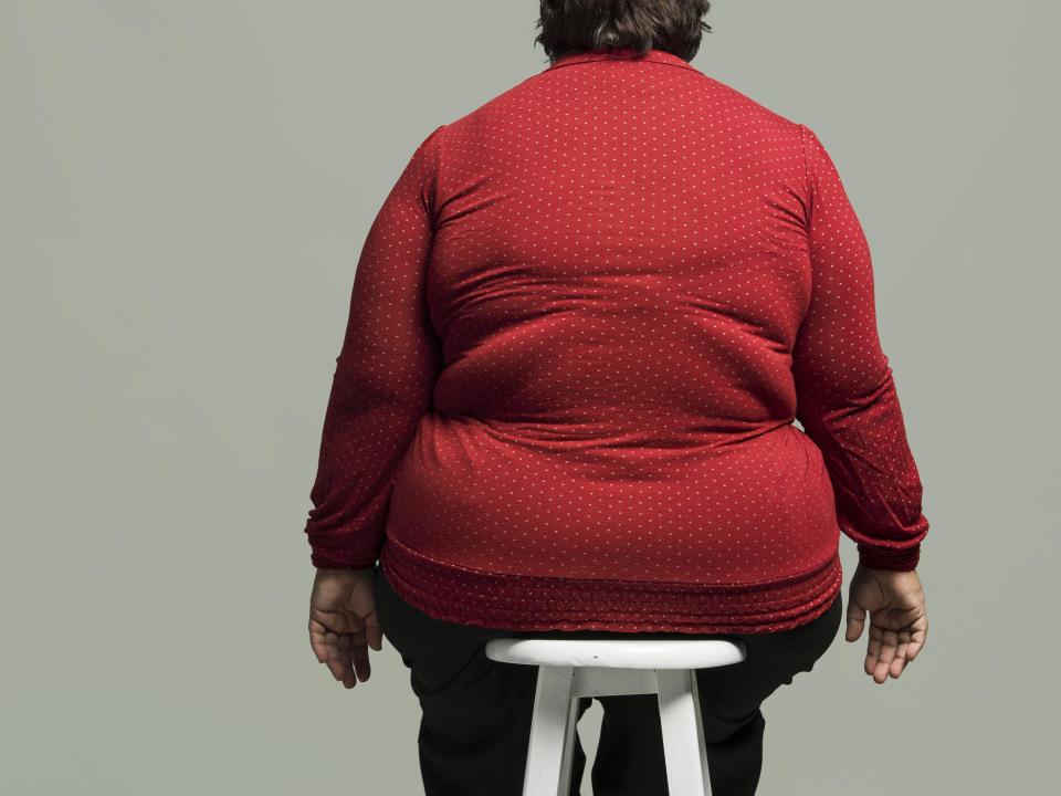  Other towns that rated highly as obese were Barnsley, Mansfield, Rotherham and Fenland