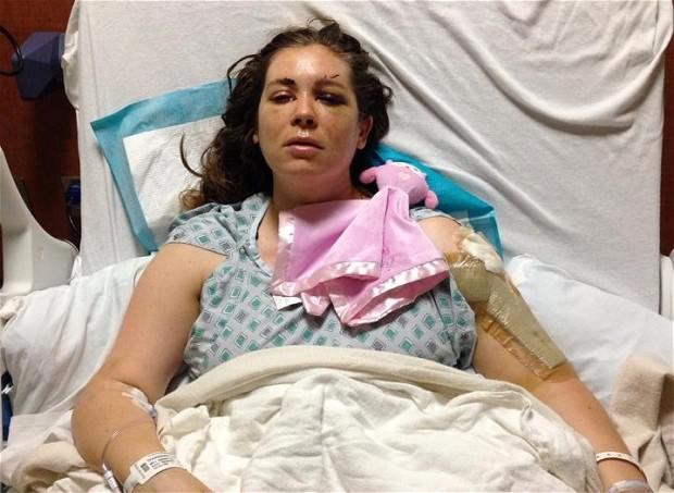  Rachel had devastating injuries and was rushed to hospital where she went straight into surgery