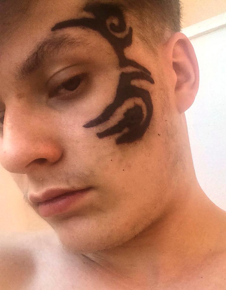  Twelve hours after the 18-year-old got his tattoo it started to ooze puss