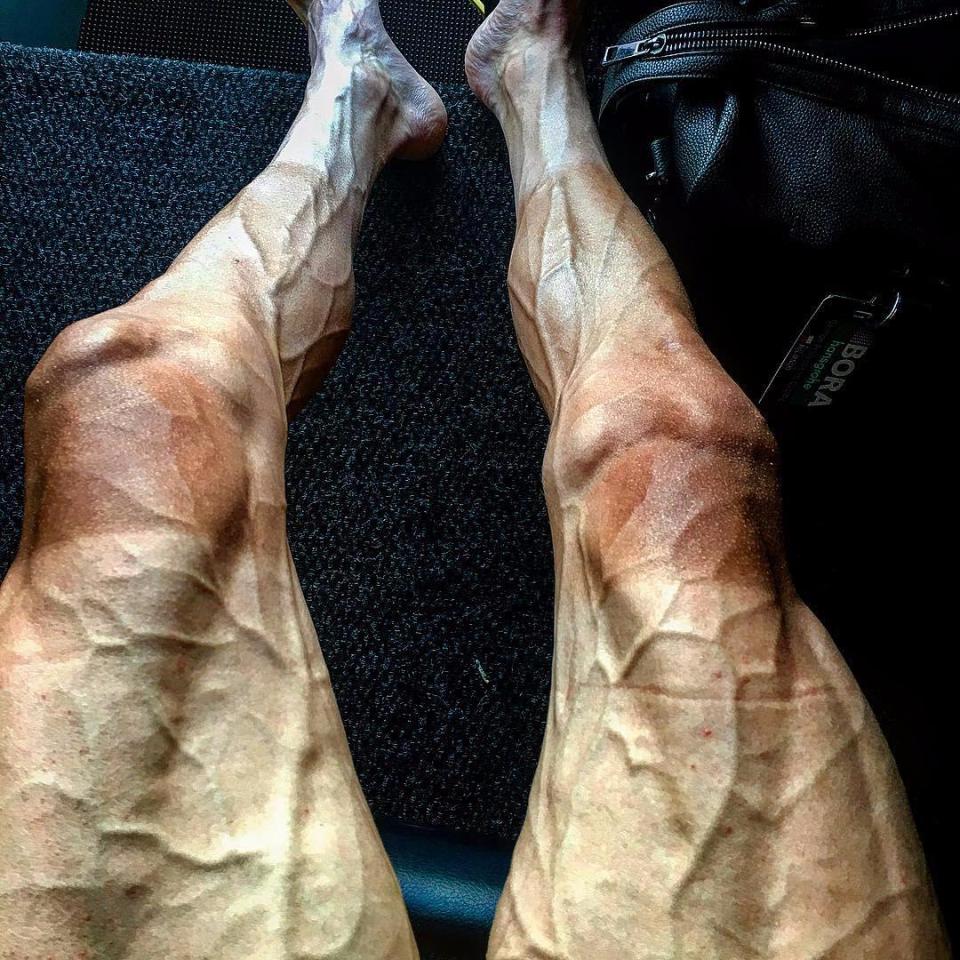  Tour de France rider Pawel Poljanski posted this picture of his throbbing, sunburnt legs on Instagram