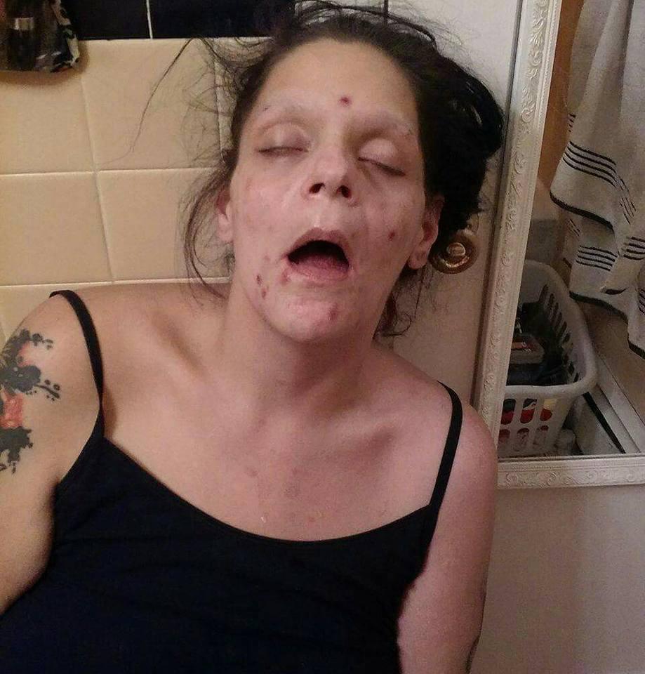  Melissa Lee Matos shared a set of harrowing pictures on Facebook